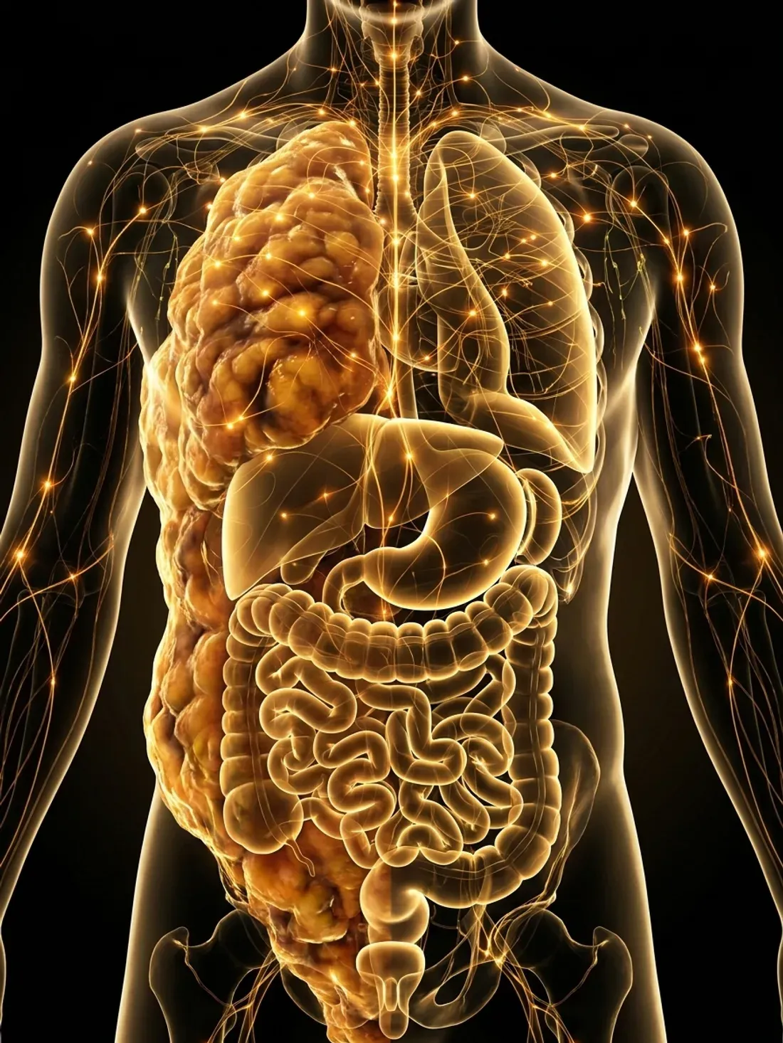 An anatomical illustration of the torso showing visceral fat surrounding the abdominal organs